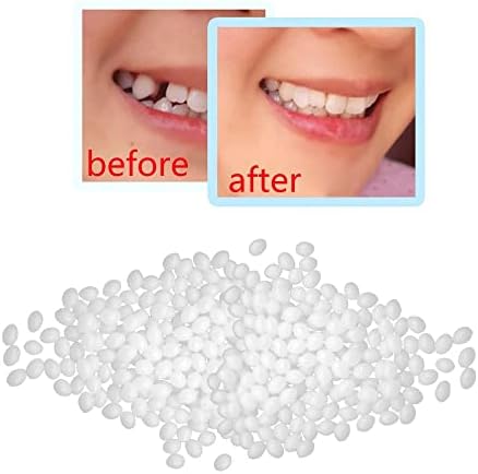 ALINSAM 200 גרם תותבת דבק מוצק שיקום שיניים ערכת תיקון שיניים זמניות